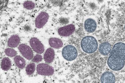 This digitally-colorized electron microscopic (EM) image depicted a monkeypox virion, obtained from a clinical sample associated with the 2003 prairie dog outbreak. It was a thin section image from of a human skin sample. On the left were mature, oval-s...