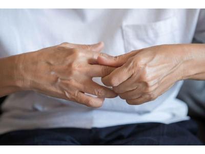 Artritis: qué es, causas, tipos, síntomas y tratamiento
