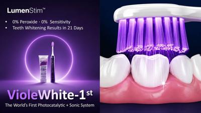 LumenStim’s next-generation peroxide-free teeth whitening system combines photocatalytic whitening technology with sonic brushing.