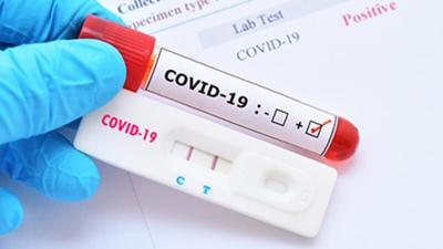 Se espera que las tasas de COVID prolongado disminuyan, según un estudio
