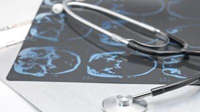 La fototerapia podría ayudar a sanar  cerebros lesionados