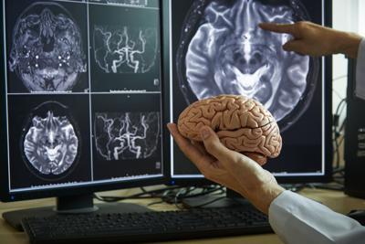 Científicos parecen haber descubierto los orígenes de la tartamudez en el cerebro
