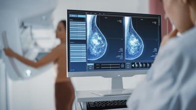 La IA lee varias mamografías para ayudar a predecir el riesgo de cáncer de mama