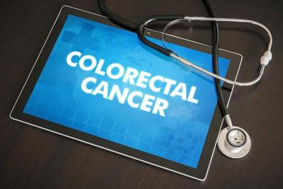 El programa de detección de cáncer de colon redujo los casos y las muertes, además de eliminar las brechas raciales