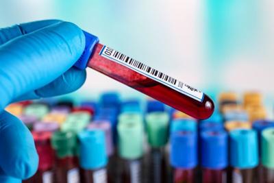 Nueva esperanza contra una leucemia difícil de tratar en adultos