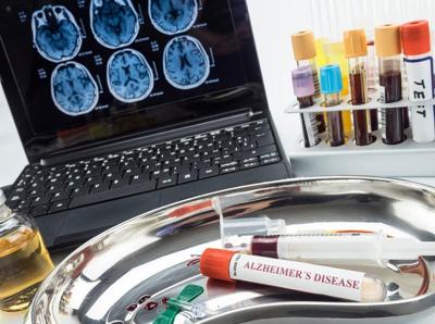 La mayoría de los estadounidenses quieren pruebas tempranas fáciles para la enfermedad de Alzheimer