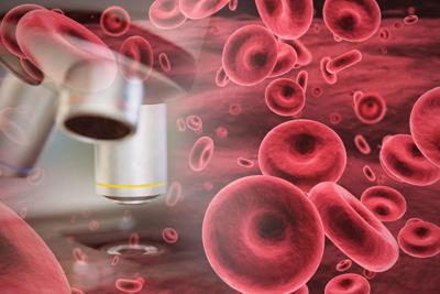 Una estrategia podría ampliar el grupo de donantes de células madre para las personas que luchan contra el cáncer de sangre