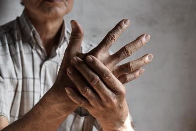 Las personas que sufren de artritis no reciben el apoyo de salud mental que necesitan, según un estudio