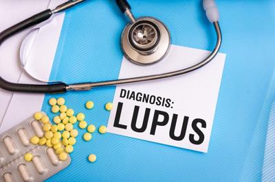 Científicos detectan la causa del lupus y la forma de revertirlo