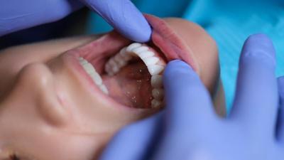 Científicos identifican los genes que dan forma a los dientes de las personas
