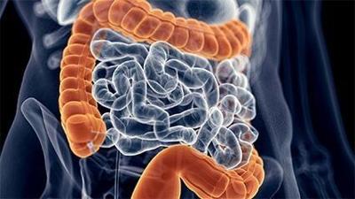 Para impulsar las pruebas de detección de cáncer de colon, se recomienda ofrecer opciones a los pacientes
