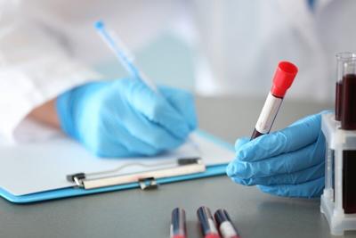¿Podrían la IA y un análisis de sangre ayudar a detectar el cáncer de pulmón a tiempo?