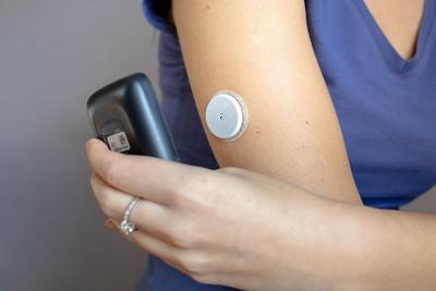Los monitores continuos de glucosa pueden sobrestimar los niveles de azúcar en la sangre, encuentra un estudio