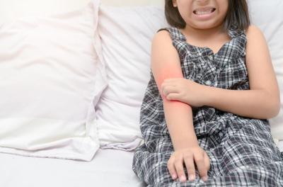 ¿Son las "dietas de exclusión" útiles contra el eczema infantil?